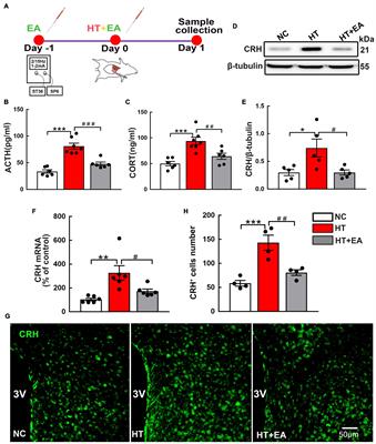 GluN2A/ERK/CREB Signaling Pathway Involved in Electroacupuncture Regulating Hypothalamic-Pituitary-Adrenal Axis Hyperactivity